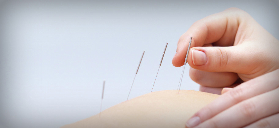 Acupuncture pour soulager la douleur